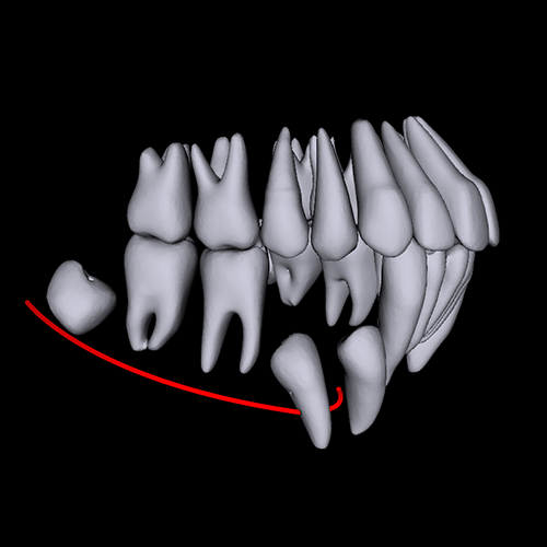Automated teeth segmentation by CephX